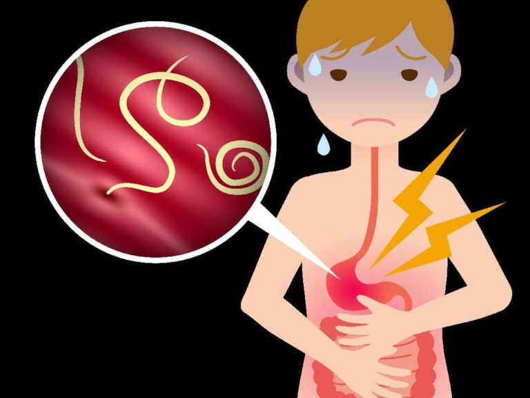 Rekomendasi Obat Cacing Alami untuk Dewasa yang Aman