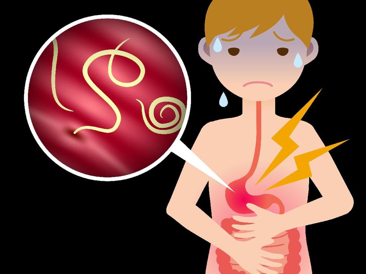 Rekomendasi Obat Cacing Alami untuk Dewasa yang Aman