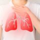 Pengobatan Infeksi Paru-paru: Langkah-Langkah untuk Menangani Masalah Pernapasan